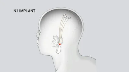 تراشه مغزی نورالینک در شرف اولین تست انسانی - دیجینوی