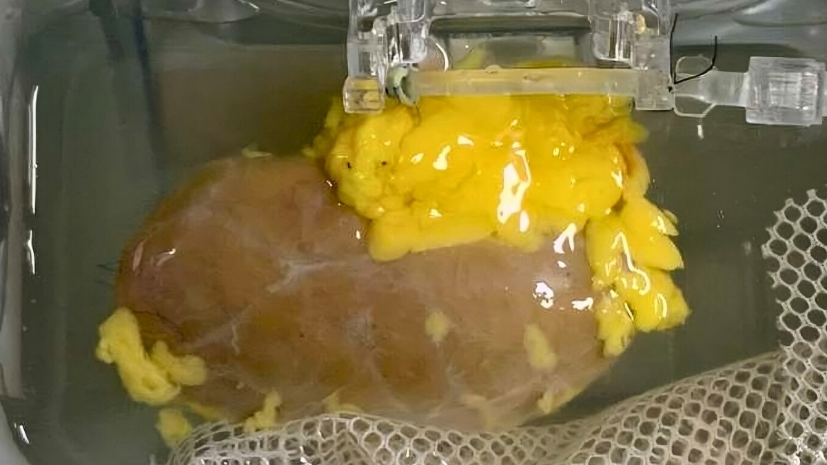 Scientists Create Universal Kidney To Match Any Blood Type1-- دانشمندان موفق به ساخت کلیه «جهانی» شدند که با هر گروه خونی سازگار است - دیجینوی