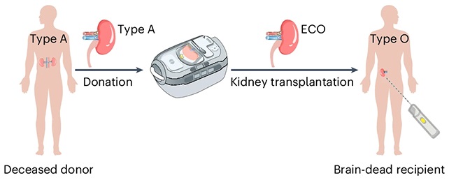 Scientists Create Universal Kidney To Match Any Blood Type1 دانشمندان موفق به ساخت کلیه «جهانی» شدند که با هر گروه خونی سازگار است - دیجینوی